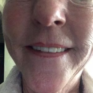 Meet your Posher, Karekaren